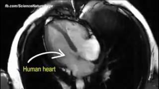 Beginilah Proses Bagian Tubuh Saat Sedang Beraktivitas Dilihat Dari X RAY