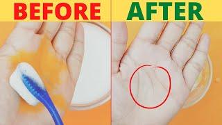 Quick Remove Yellow Turmeric Stains from Skin & Nails  5-Minute Bright Side