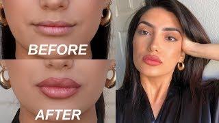 HOW TO FAKE BIG LIPS IN 3 EASY STEPS OMG