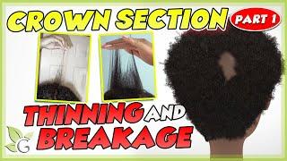 Crown SORENESS and BREAKAGE - Causes and Solutions Part 1