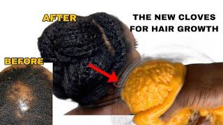 If Nothing works for your hair try this home made hair growth recipe for thicker and longer hair