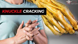 How Harmful Is It to Pop Your Knuckles?