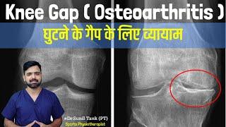 Knee gap exercises in hindi - exercise for knee pain  knee osteoarthritis pain  Dr. Sunil Tank