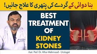 Kidney Stone Treatment  Gurde ki Pathri Ka Dawai Se ilaj in UrduHindi