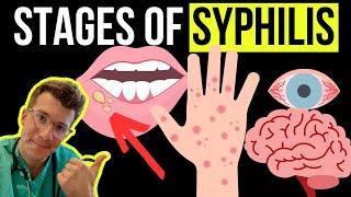 Doctor explains the Symptoms and Stages of SYPHILIS STI