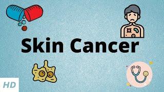 Skin Cancer Causes Signs and Symptoms Diagnosis and Treatment.