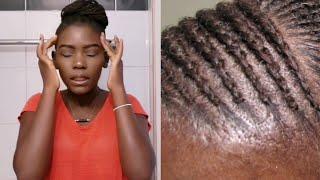 How to  loosen tight sore braids cornrows in minutes. After braiding