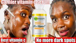 HOW TO PROPERLY USE GARNIER VITAMIN C SERUM TO GET RID OF DARK SPOTS AND HYPERPIGMENTATION +Review