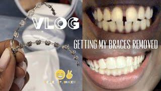 VLOG FINALLY GETTING MY BRACES REMOVED  MY BRACES JOURNEY & POST REMOVAL UPDATE  thickeray