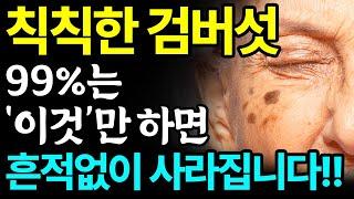 집에서 검버섯 없애는 방법 3가지 총정리 피부과에 헛돈 쓰지마세요 따라만 하면 검버섯 기미 번지지 않고 싹 다 사라집니다