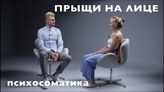 ПСИХОСОМАТИКА ПРЫЩЕЙ НА ЛИЦЕ. ПРАКТИЧЕСКАЯ СЕССИЯ