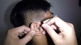 Removing A Bubble Gum Stuck in Mans Ear - This is Insane