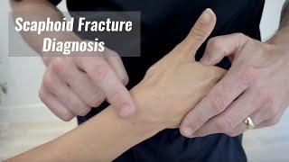 Scaphoid fracture diagnosis - Anatomical snuff box