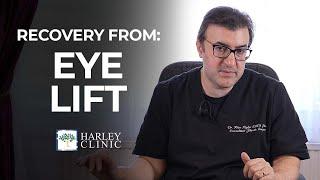 How Long Does Recovery Take For An Eye Lift?  Eye Lift Surgery Recovery Guide