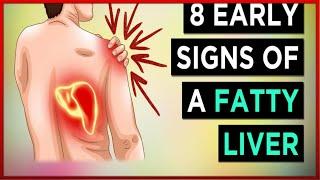 8 SIGNS that your LIVER is DYING  DANGEROUS