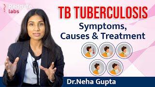 What is Tuberculosis TB? Tuberculosis Symptoms Causes And Treatment  Symptoms of Tuberculosis