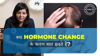 Hair Fall or Hair Loss Due To Hormonal Changes  Male vs Female Baldness Pattern