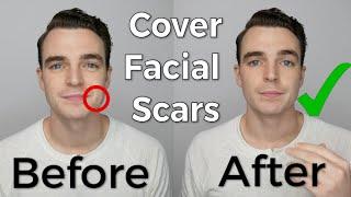 Using Mens Concealer to Cover Acne Scars Or Most Facial Scars