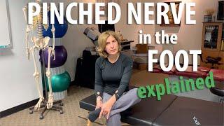 Pinched Nerve in the Foot explained by Irvine Posture and Chiropractic Doctor