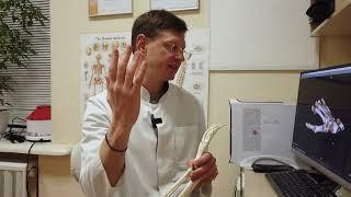 Перелом лучевой кости в типичном месте когда необходимо оперировать? Сколько держать гипс?