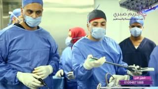 عملية تكميم المعدة بالمنظار من داخل غرفة العمليات - مركز دكتور كريم صبري