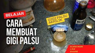 Cara Membuat Gigi Palsu Akrilik Dengan Cepat Dan Bagus