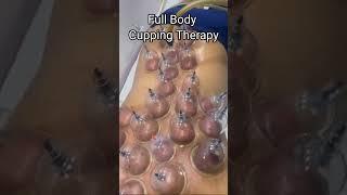 Full Body Cupping Therapy  Gujarat Hijama Therapy #hijamatherapy #cuppingtherapy #hijama #shorts