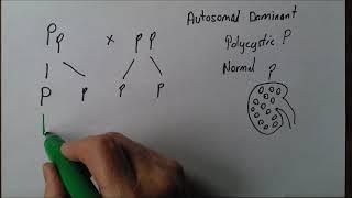 Introducing Genetics 4 Autosomal dominant inheritance