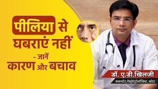 पीलिया कैसे होता है  पीलिया के लक्षण कारण और इलाज  What Causes Jaundice?  Dr. A.D. Khilji