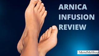 Excellent review of MendMeShops arnica infusion for edema relief in the feet