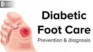 Diabetic Foot Care  Prevention and Diagnosis - Dr. Mohan M R