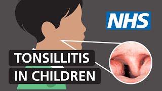 Tonsillitis in children Symptoms and treatment  NHS