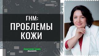 ПРОБЛЕМЫ КОЖИ и ГНМ  Анастасия Семко