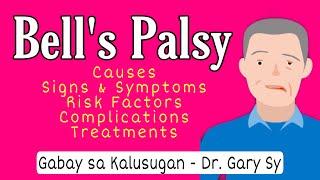 Bells Palsy Causes Signs Symptoms Diagnosis & Treatments - Dr. Gary Sy