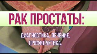 Рак простаты причины симптомы диагностика лечение