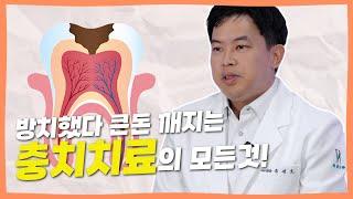 충치 발생 위치에 따른 통증과 충치 치료방법