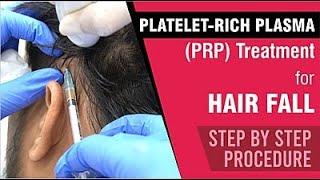 Platelet-Rich Plasma PRP Treatment for Hair fall  Step by Step Procedure  Sakhiya Skin Clinic