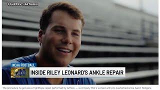 WNDU 16 News Now Details Arthrex Innovation Used in Riley Leonards Ankle Repair