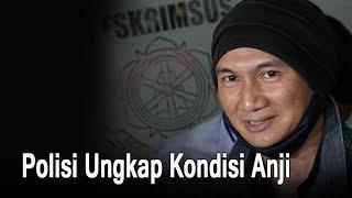 Polisi Ungkap Kondisi Anji