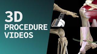 Start exploring a suite of 3D procedure videos in Complete Anatomy