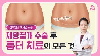 분당차여성병원  제왕절개 후 흉터 치료의 모든 것_산부인과 이지연 교수