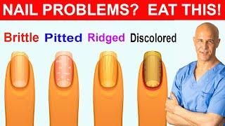 NAIL PROBLEMS ?  EAT THIS     Dr. Mandell