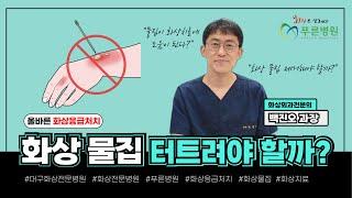 Dr.백과 함께 하는 화상응급처치방법 4탄 - 화상물집 터트려야 할까?