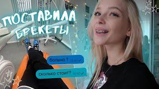 ПОСТАВИЛА БРЕКЕТЫ ⭐︎ больно? сколько стоит?  НЕДЕЛЯ С БРЕКЕТАМИ  отвечаю на вопросы