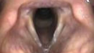 Anatomical Tutorial During Trans-Nasal Endoscopy