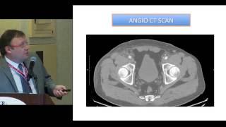 Magellan Case Iliac CTO Crossing Strasbourg France