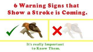 6 Warning Signs That Show a Stroke Is Coming II Its important to know them II #StudyRoom
