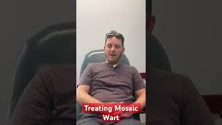 Mosaic wart treatment with Swift #drpelto #swift