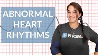 EKG like a BOSS Part 3 - Abnormal Heart Rhythms