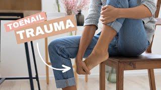 Dont Ignore Toenail Trauma Risks and Long-term Effects - Podiatrist Georgina Tay